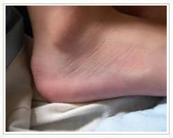 Slider image (8) Laser Foot Surgery Specialist